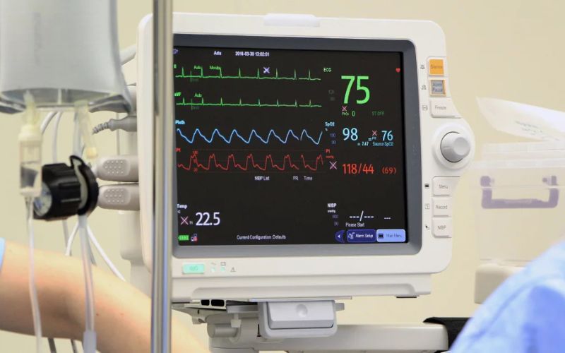 ECG monitoring system