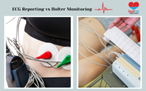 ecg reporting vs holter monitoring